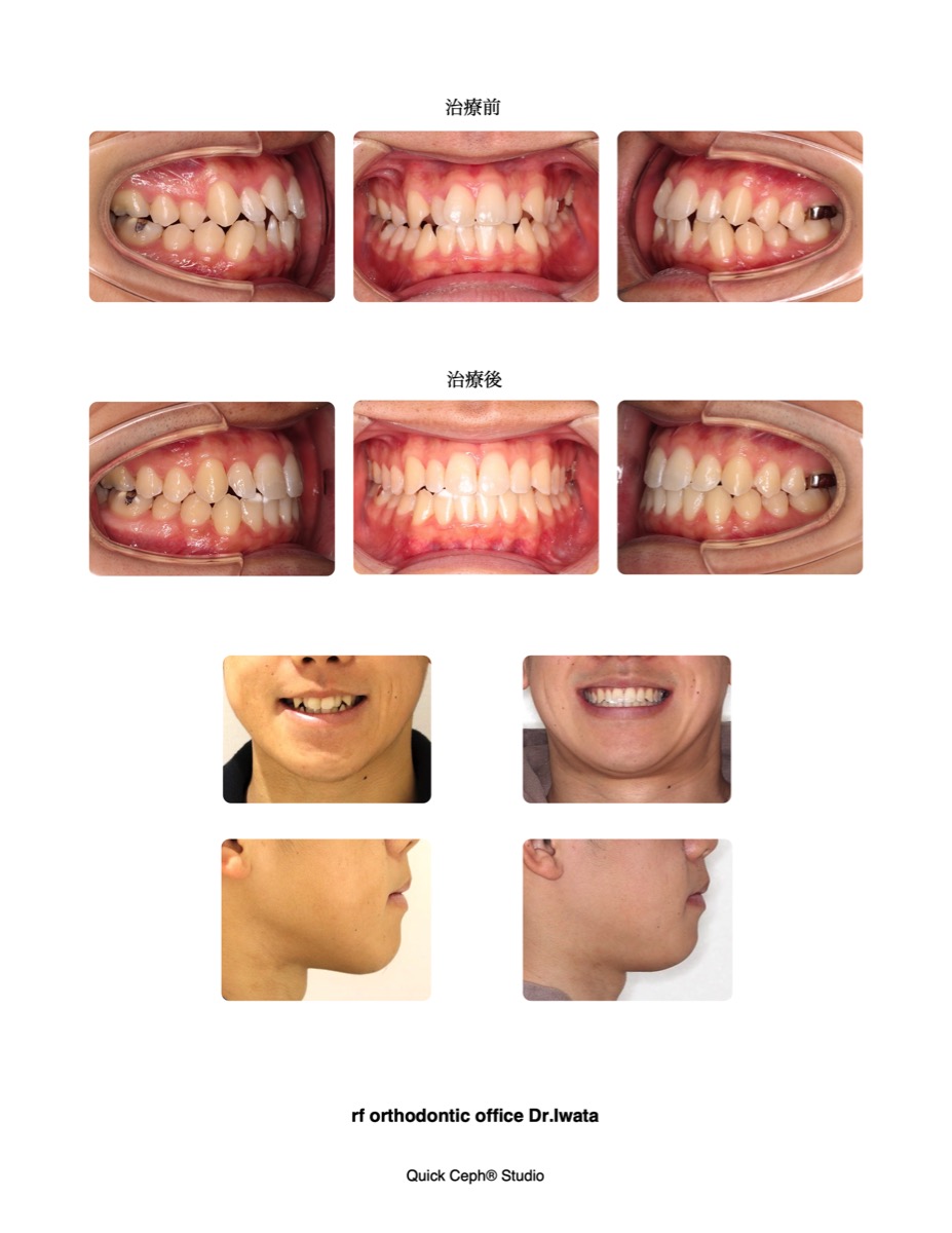 Comparison-comparison-HP2.jpg