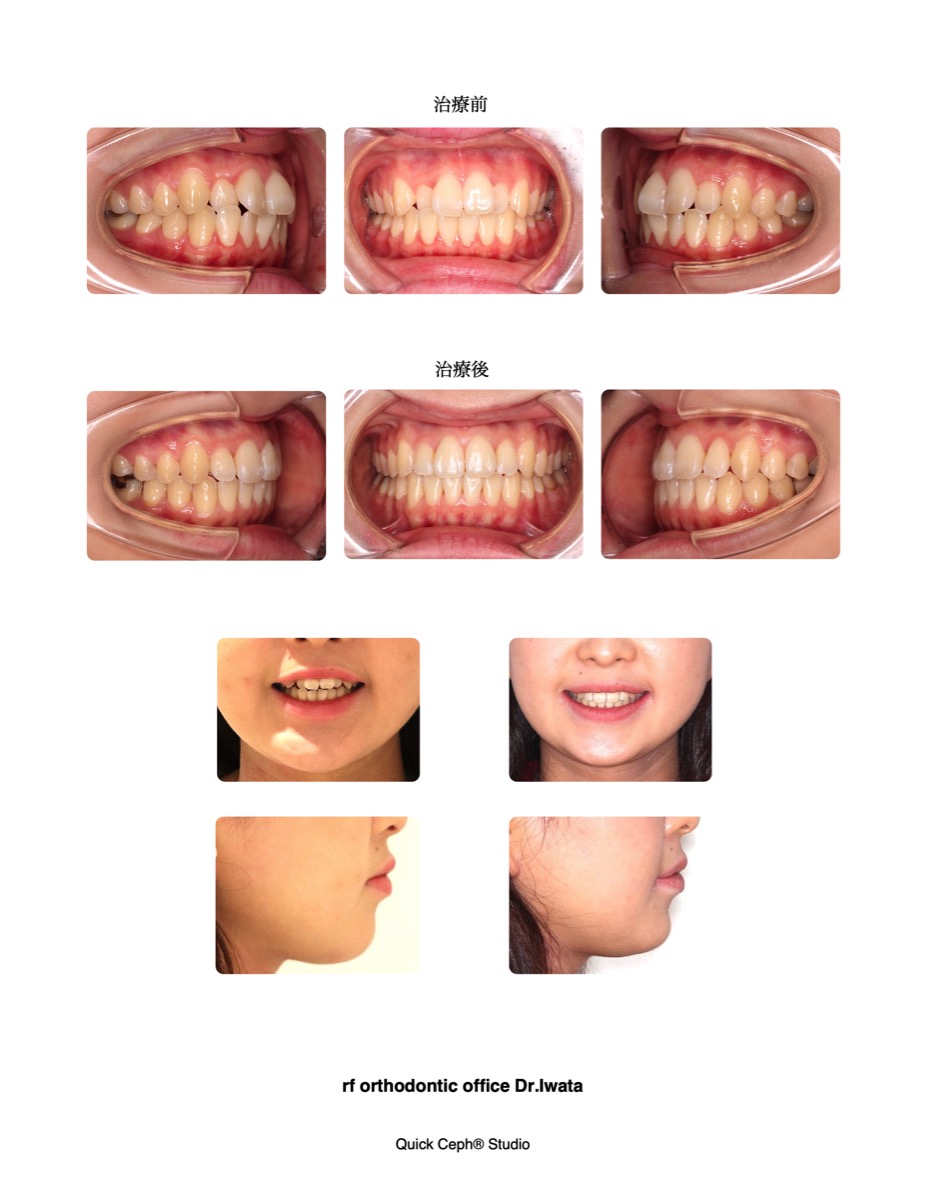 Comparison-comparison-HP2.jpg