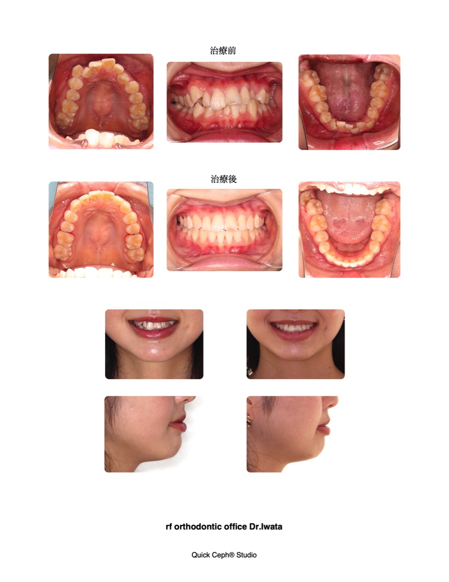 Comparison-comparison-HP.jpg