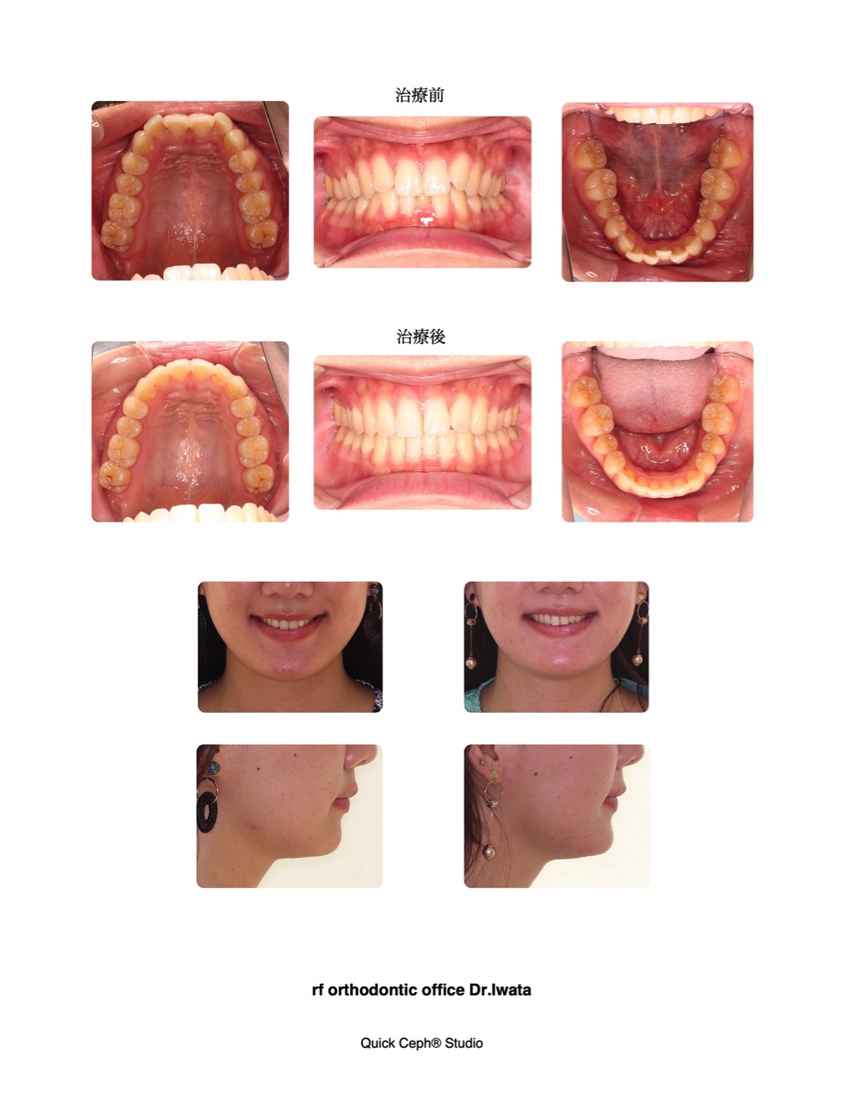 歯科矯正学　バイオプログレッシブ診断学 バイオプログレッシブ診断学 (歯科矯正学) |本 | 通販 | Amazon